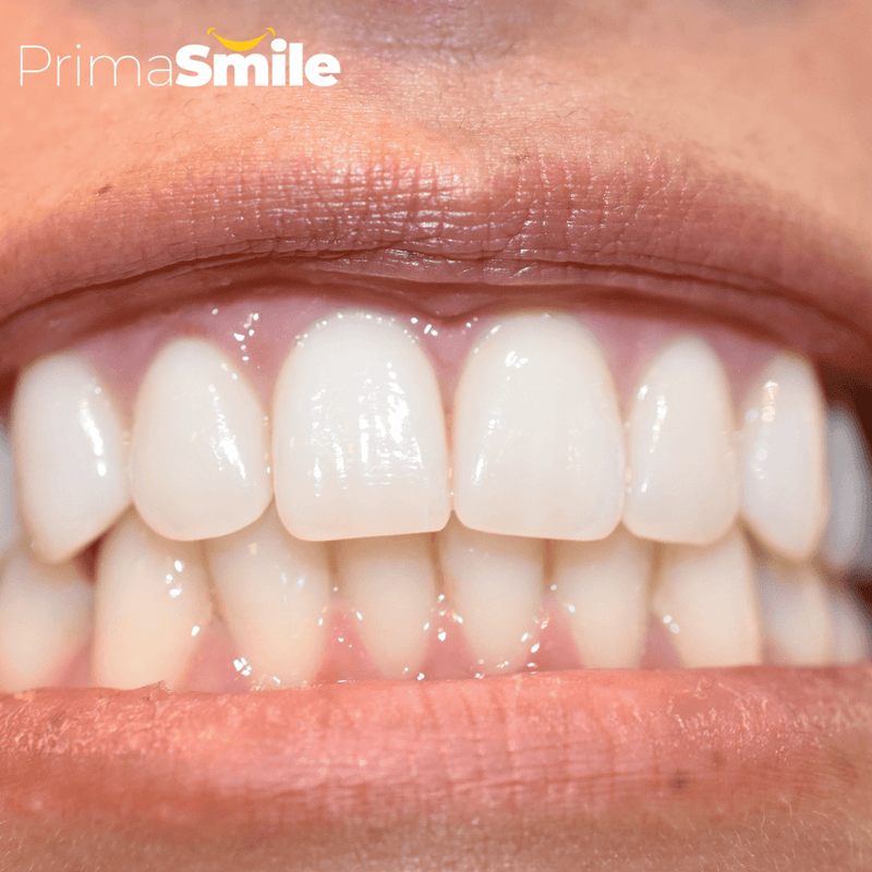 PRIMA SMILE™ Dental Floss Featured Image 1