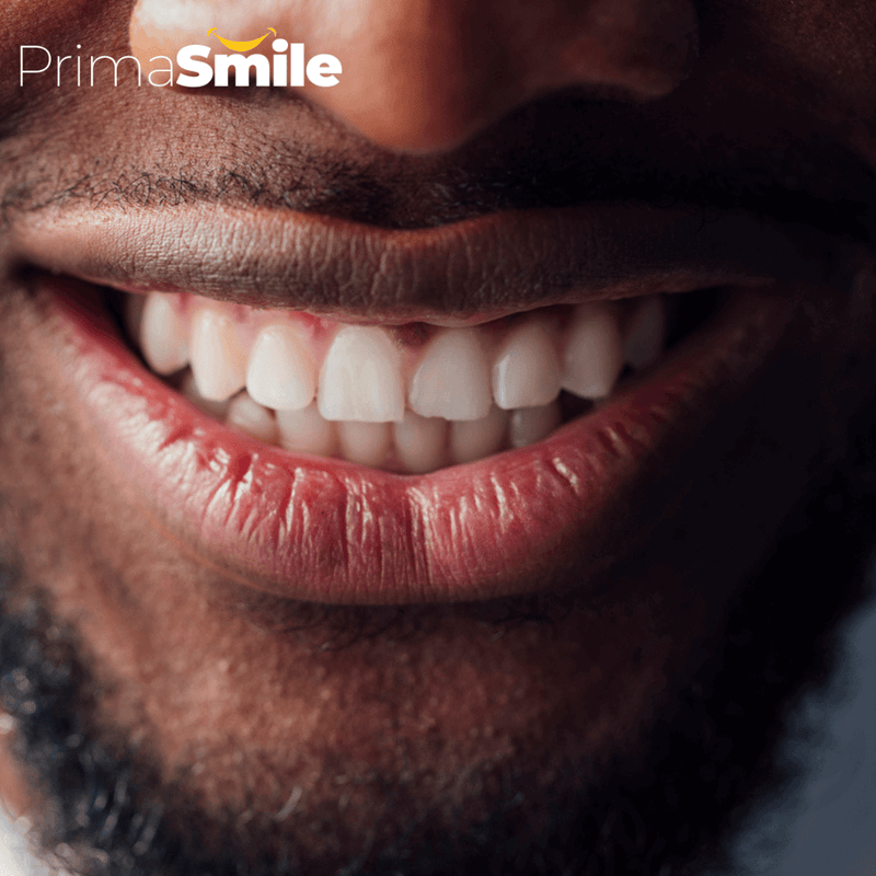 PRIMA SMILE™ Dental Floss Featured Image 6